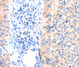 Anti-Human ANK3 Antibody - ABMIUM