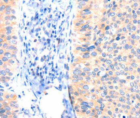 Anti-Human ANK3 Antibody
