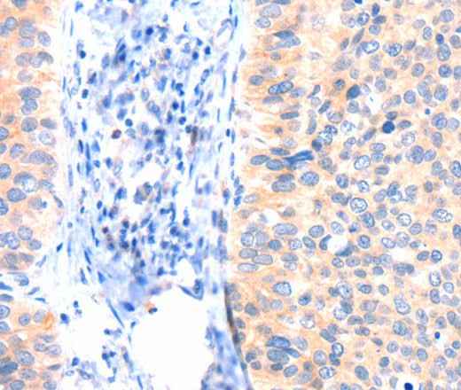 Anti-Human ANK3 Antibody