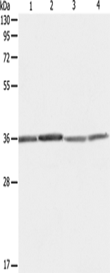 Anti-Human/Mouse/Rat RPLP0 Antibody - ABMIUM