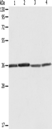 Anti-Human/Mouse/Rat RPLP0 Antibody - ABMIUM