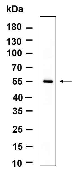 Anti-Human/Mouse/Rat TXNIP Antibody [B947] - ABMIUM