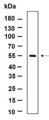 Anti-Human/Mouse/Rat TXNIP Antibody [B947]