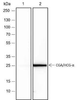 Anti-Human CGA/hCG alpha Antibody [A185]