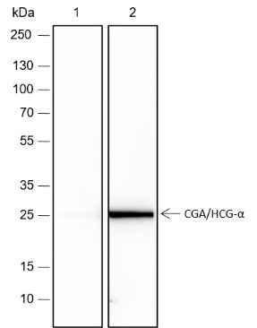 Anti-Human CGA/hCG alpha Antibody [A185] - ABMIUM