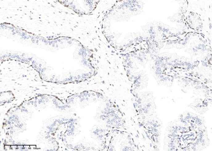 Anti-Human KLK15 Antibody [A977] - ABMIUM