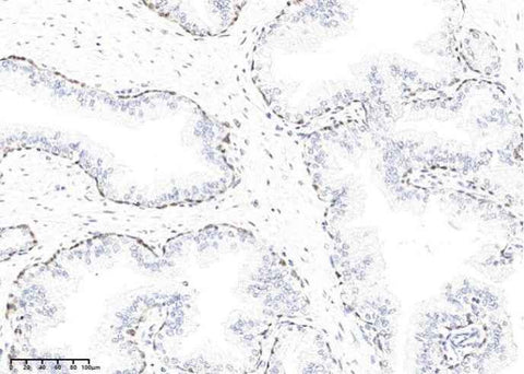 Anti-Human KLK15 Antibody [A977] - ABMIUM
