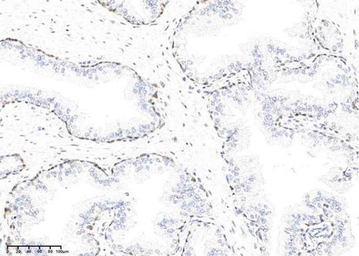 Anti-Human KLK15 Antibody [A977] - ABMIUM
