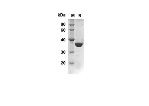 SDS-PAGE analysis of Rat SOD2 proteins, 2 μg/lane of Recombinant Rat SOD2 proteins was resolved with SDS-PAGE under reducing conditions, showing bands at 34.6 kDa.
