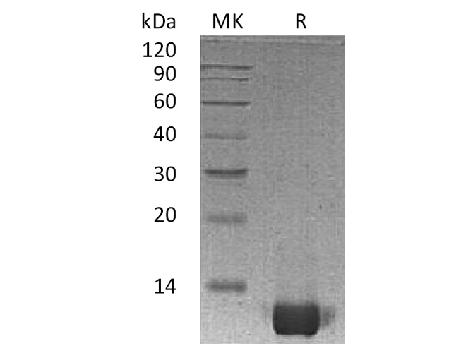 Recombinant Human IL-8/CXCL8 Protein (aa 23-99) - ABMIUM