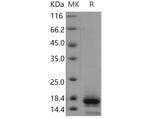 Recombinant Human TSPAN8/Tetraspanin 8 Protein (His Tag) - ABMIUM