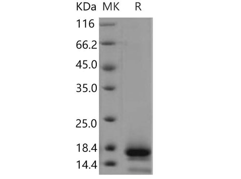 Recombinant Human TSPAN8/Tetraspanin 8 Protein (His Tag) - ABMIUM