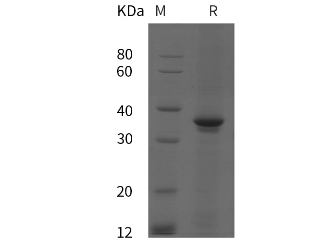 SDS-PAGE analysis of Human PⅢNP proteins, 2 μg/lane of Recombinant Human PⅢNP proteins was resolved with SDS-PAGE under reducing conditions, showing bands at 35 kDa.