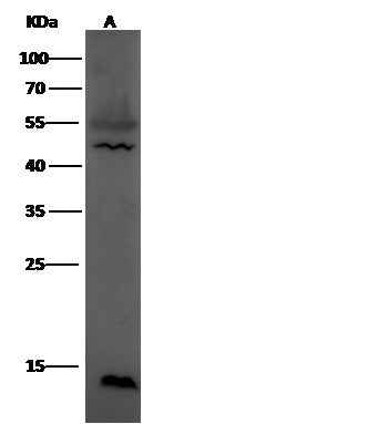 Anti-Human LEP Antibody [A945] - ABMIUM