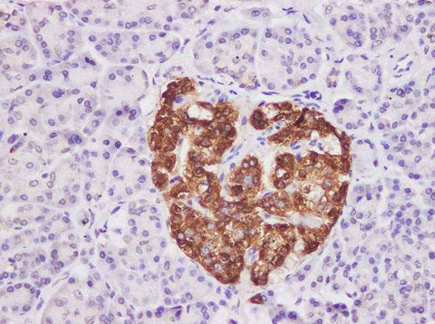 Anti-Human CHGA Antibody - ABMIUM