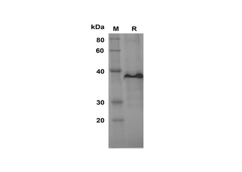 SDS-PAGE analysis of Human TRIM37 proteins, 2 μg/lane of Recombinant Human TRIM37 proteins was resolved with SDS-PAGE under reducing conditions, showing bands at 38 kDa.