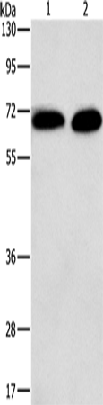 Anti-Human/Mouse/Rat PRKCA Antibody - ABMIUM