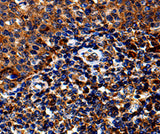 Anti-Human/Mouse IL13RA1 Antibody - ABMIUM