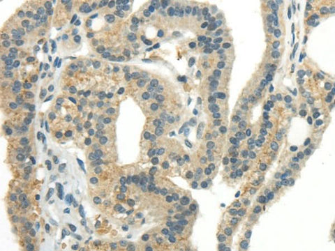 Anti-Human CCL13 Antibody - ABMIUM