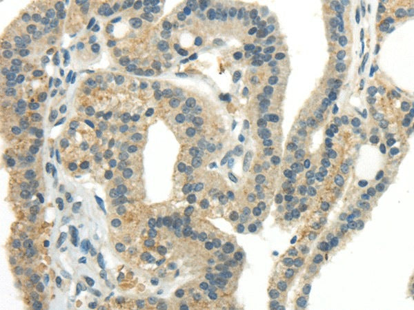 Anti-Human CCL13 Antibody - ABMIUM
