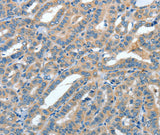 Anti-Human/Mouse/Rat ANGPT1 Antibody - ABMIUM