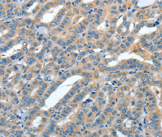 Anti-Human/Mouse/Rat ANGPT1 Antibody - ABMIUM