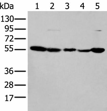 Western blot analysis of 293T cell lysates using PFKFB3 Polyclonal Antibody at dilution of 1:200