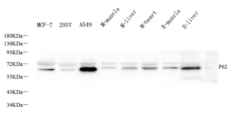 Western Blot analysis of various samples using P62/SQSTM1 Polyclonal Antibody at dilution of 1:1000.
