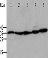 Anti-Human/Mouse/Rat ANXA5 Antibody - ABMIUM