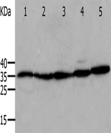Anti-Human/Mouse/Rat ANXA5 Antibody - ABMIUM