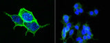 Anti-Human CA12 Antibody [A1033] - ABMIUM