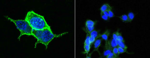 Anti-Human CA12 Antibody [A1033] - ABMIUM