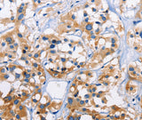 Anti-Human/Mouse/Rat CAPZA3 Antibody - ABMIUM