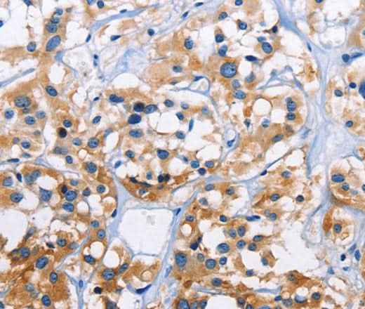 Anti-Human/Mouse/Rat CAPZA3 Antibody