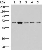 Western blot analysis of 293T LOVO Hela and Jurkat cell lysates using CHEK2 Polyclonal Antibody at dilution of 1:600