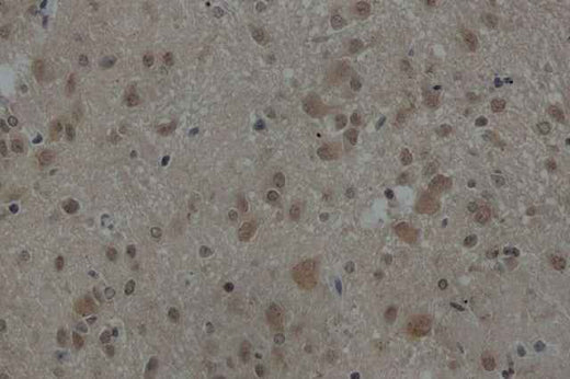 Anti-Human/Mouse/Rat AKT1 Antibody