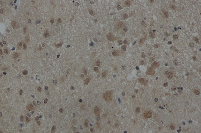 Immunohistochemistry of paraffin-embedded Rat brain using AKT1 Polyclonal Antibody at dilution of 1:50