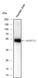 Anti-Human/Mouse ANGPTL3 Antibody [A133]
