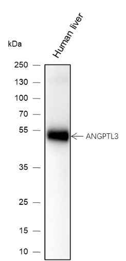 Anti-Human/Mouse ANGPTL3 Antibody [A133] - ABMIUM