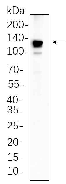 Anti-Human/Mouse/Rat PYK2 Antibody [B571] - ABMIUM
