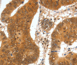 Anti-Human/Mouse SPDEF Antibody - ABMIUM