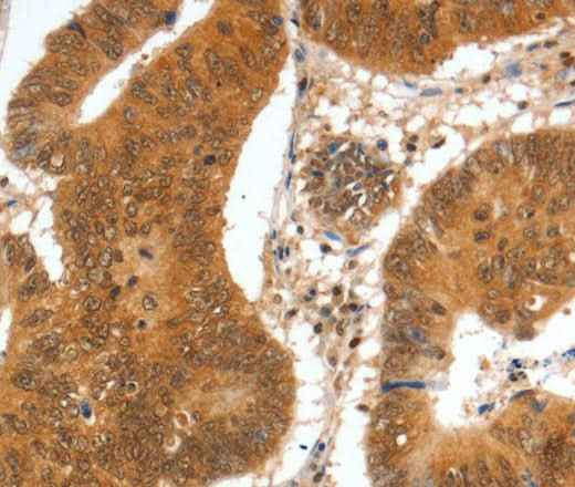 Anti-Human/Mouse SPDEF Antibody