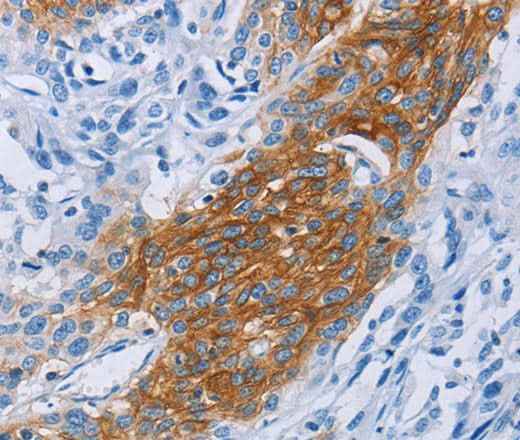 Anti-Human/Mouse CCR9 Antibody