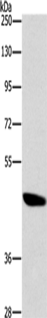 Anti-Human/Mouse/Rat BRS3 Antibody - ABMIUM
