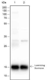 Anti-Human/Rat/Mouse Luteinizing Hormone beta Antibody [A289]