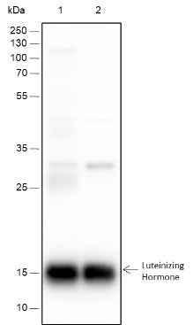 Anti-Human/Rat/Mouse Luteinizing Hormone beta Antibody [A289] - ABMIUM