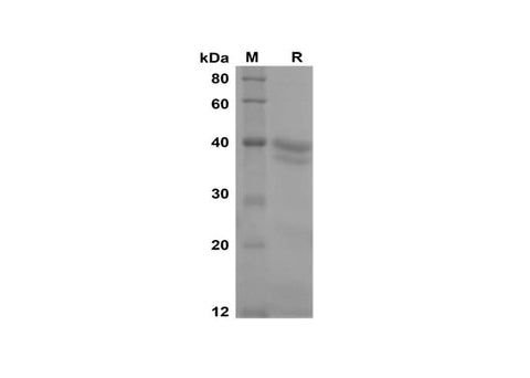 SDS-PAGE analysis of Human FGF21 proteins, 2 μg/lane of Recombinant Human FGF21 proteins was resolved with SDS-PAGE under reducing conditions, showing bands at 40 kDa.