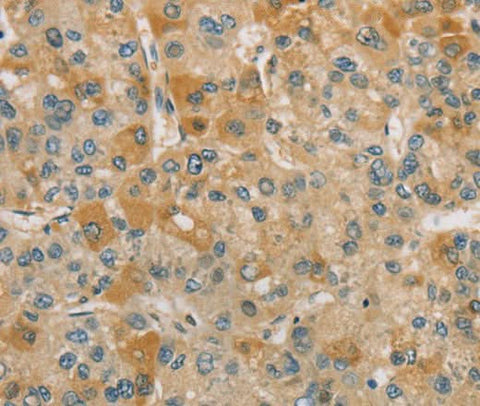 Anti-Human CENPF Antibody - ABMIUM
