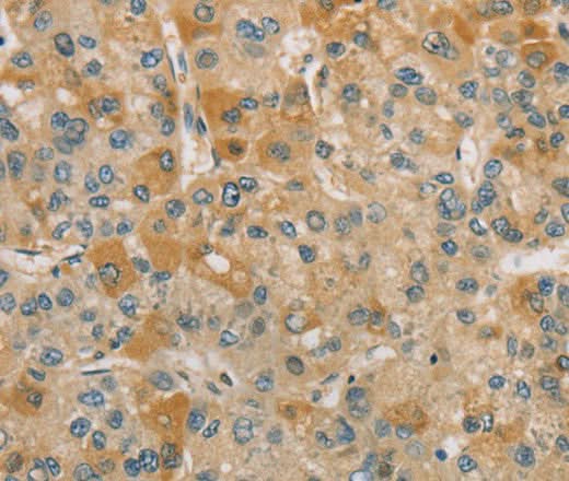Anti-Human CENPF Antibody - ABMIUM