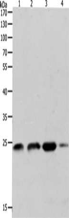 Anti-Human/Mouse/Rat RHOA Antibody - ABMIUM